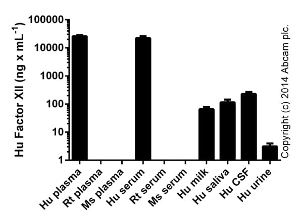 Human Factor XII ELISA Kit(AB108835)