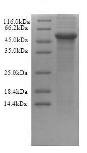 Recombinant Human CRBN protein (His tag)(AB235611)