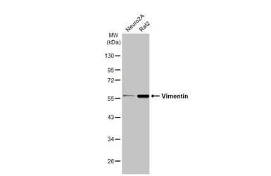 Anti-Vimentin antibody(AB137321)