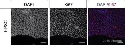 Anti-Ki67 antibody [MKI67/2465](AB238020)