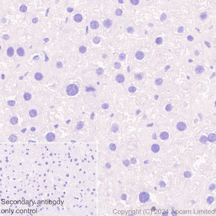 Anti-PADI2 / PAD2 antibody [EPR26940-85](ab322197)
