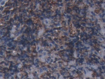 Anti-Ferritin Heavy Chain antibody(AB231253)