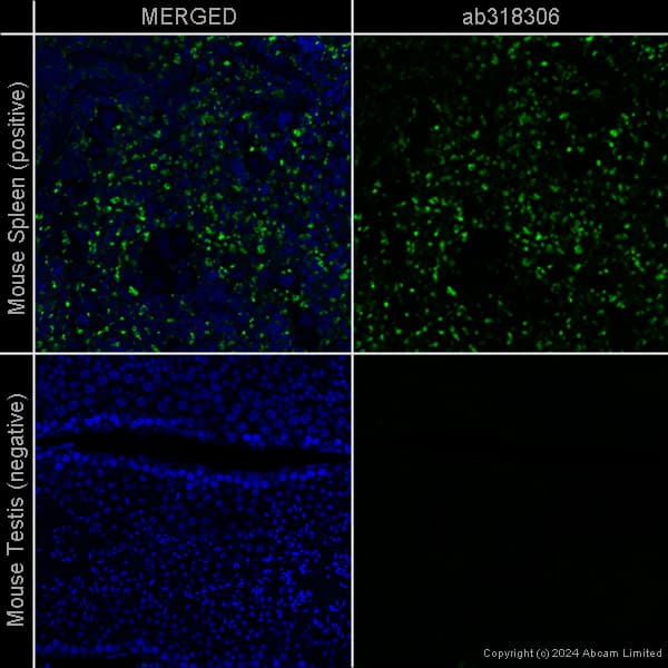 Anti-CD68 antibody [EPR23917-164] – Chicken IgY (Chimeric)(AB318303)