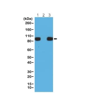 6x His Tag Antibody Rm146 Ab200537  Immunoprecipitation Img350