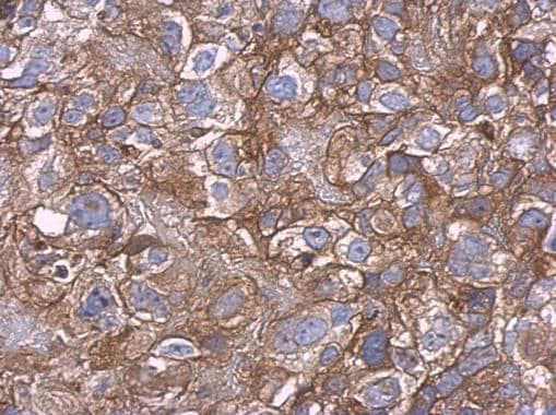 Carbonic Anhydrase 9 Ca9 Antibody Ab184006 Immunohistochemistry Formalin Pfa Fixed Paraffin Embedded Sections Img112374
