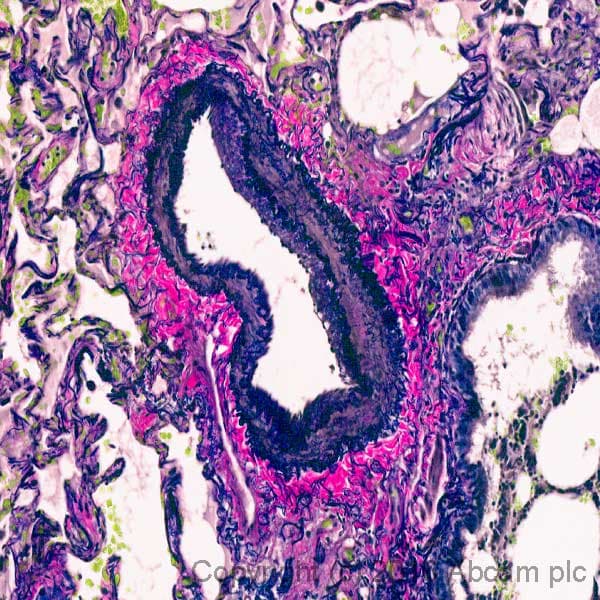 Elastic Stain Kit (Verhoeff Van Gieson / EVG Stain)(AB150667)