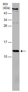 Beta 2 Microglobulin Antibody Ab227261  Western Blot Img86366