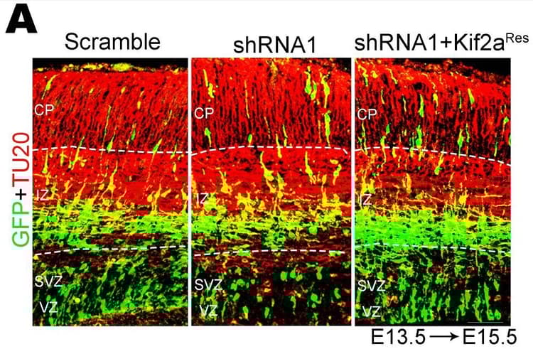 Anti-beta III Tubulin antibody [TU-20] - Neuronal Marker(ab7751)