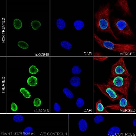 Anti-Histone H3 (acetyl K14) antibody [EP964Y] - ChIP Grade(AB52946)