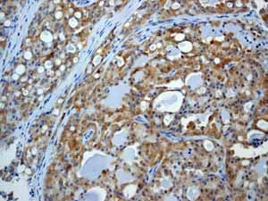 Anti-EIF2S1 (phospho S51) antibody [E90](AB32157)