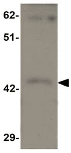 Shisa9 Antibody Ab105208  Western Blot Img24549