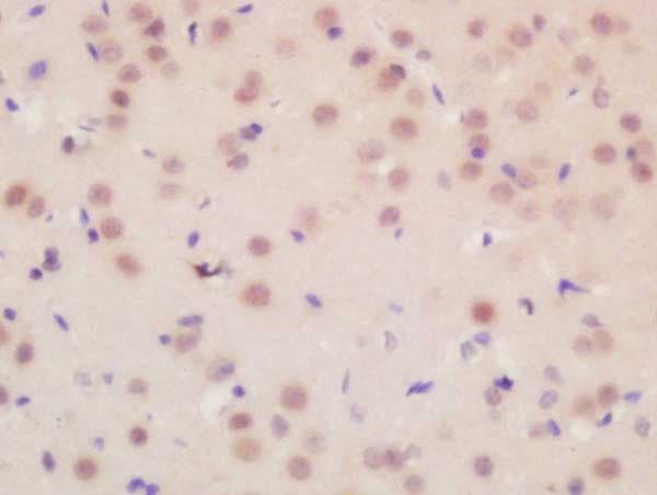 Flrt3 Antibody Ab214188  Immunohistochemistry Formalin Pfa Fixed Paraffin Embedded Sections Img34435