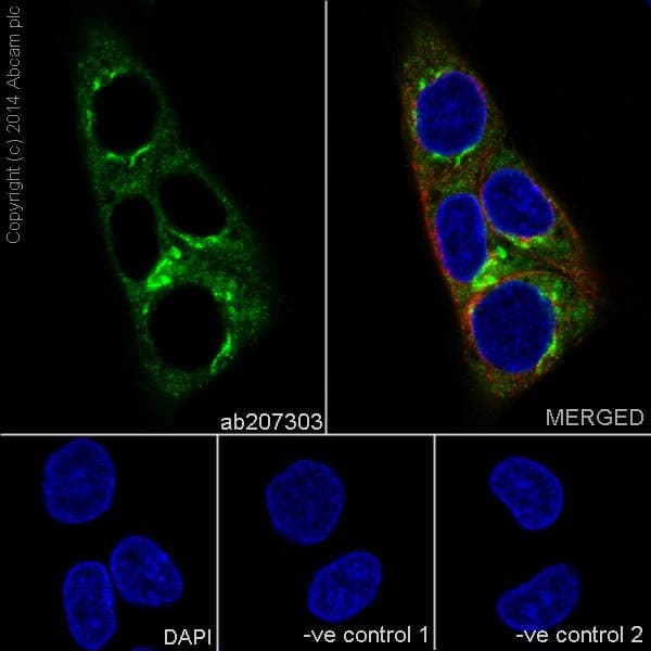 Anti-alpha 1 Antitrypsin antibody [EPR17087-50](AB207303)