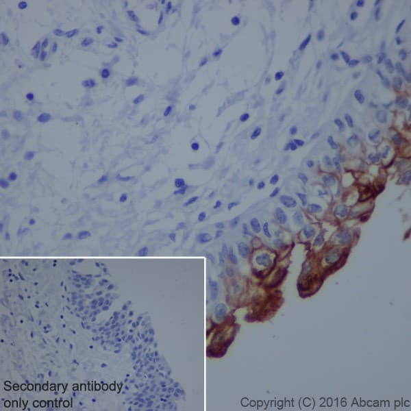 Anti-Uroplakin II/UPII antibody [EPR18799] - BSA and Azide free(AB224261)