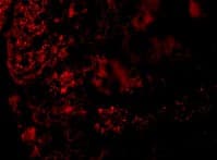 Anti-Angiotensin II Type 1 Receptor antibody(AB124505)