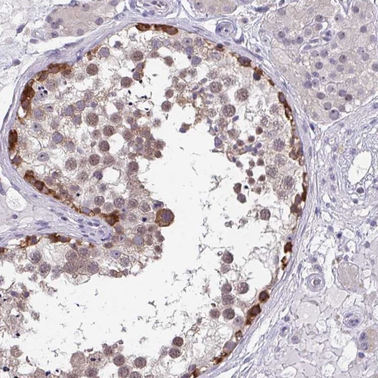 Riok1 Rio1 Antibody Ab254723  Immunohistochemistry Formalin Pfa Fixed Paraffin Embedded Sections Img77835