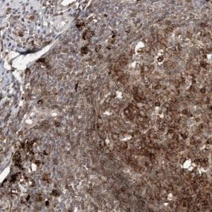 Apc15 Antibody Ab122349  Immunohistochemistry Formalin Pfa Fixed Paraffin Embedded Sections Img73913