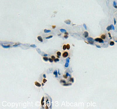 Anti-Histone H2A.X antibody - ChIP Grade(AB20669)