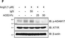 Adam17 Phospho T735 Antibody Ab182630  Western Blot Img443028