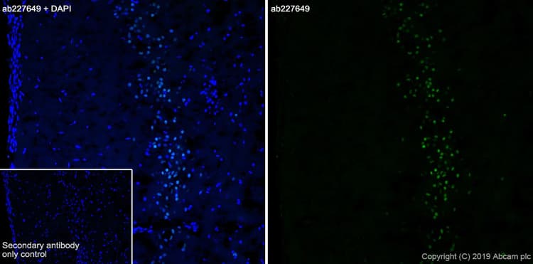 Anti-FOXP1 antibody [SP133] - C-terminal(AB227649)
