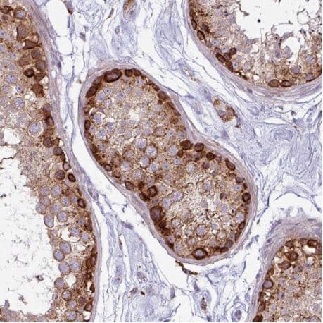 Map7d2 Antibody Ab151140  Immunohistochemistry Formalin Pfa Fixed Paraffin Embedded Sections Img130359