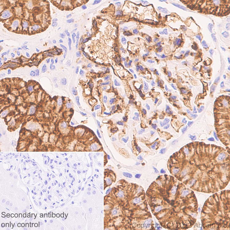 Aquaporin 1 Antibody Epr26554 46 Bsa And Azide Free Ab300464  Immunohistochemistry Formalin Pfa Fixed Paraffin Embedded Sections Img400421