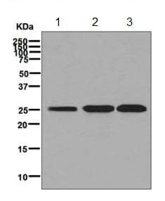 Ak3l1 Antibody Epr7678 Ab131327  Western Blot Img71200