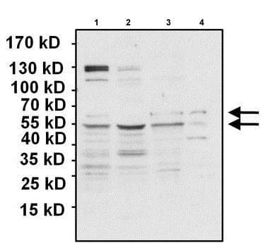 Anti-PAX7 antibody(AB187339)