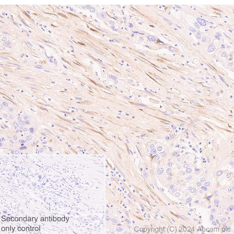 Pai1 Antibody Epr21850 262 Bsa And Azide Free Ab317605  Immunohistochemistry Formalin Pfa Fixed Paraffin Embedded Sections Img431899