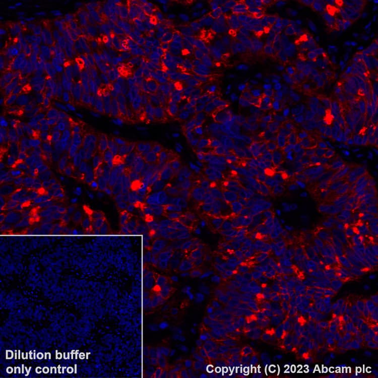 Alexa Fluor® 555 Anti-Folate Binding Protein/FBP antibody [EPR20277](ab309247)