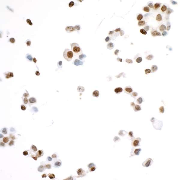 Ki67 Antibody Blr021e Ab243878  Immunocytochemistry Img168339