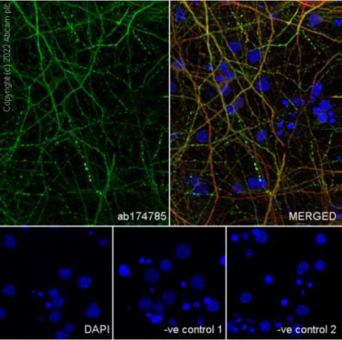 Anti-MAP2 antibody [EPR19691](AB183830)