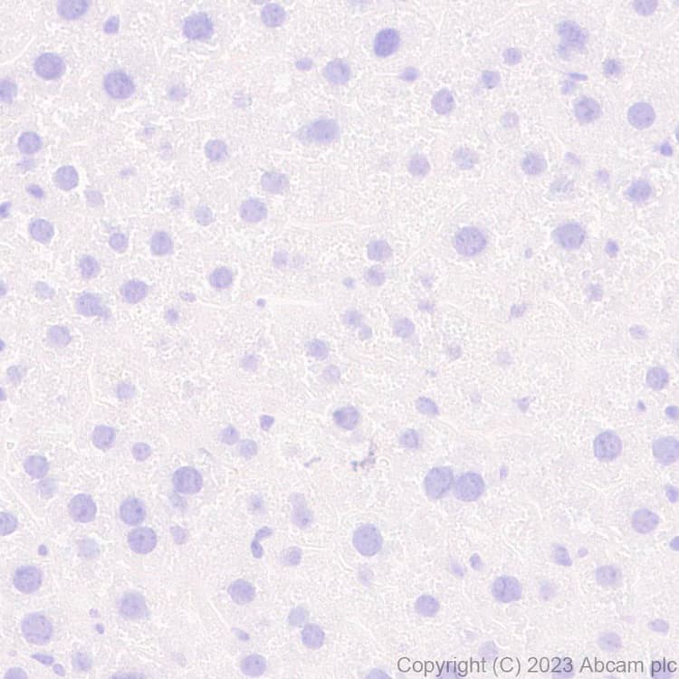 Anti-Aggrecan antibody [EPR28034-86](AB313636)