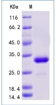 Recombinant Mouse IgG protein(AB276304)