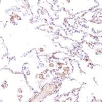 Anti-CD14 antibody [SP192](AB183322)