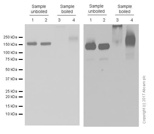 Anti-P Glycoprotein antibody [EPR10364-57](AB170904)