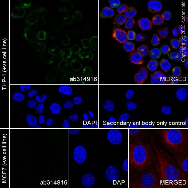 Anti-Neutrophil Elastase antibody [RM1077](AB314916)