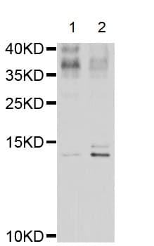 Elafin Esi Antibody Ab192345  Western Blot Img4972