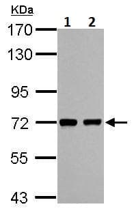 Hcc1 Antibody Ab229238  Western Blot Img88058