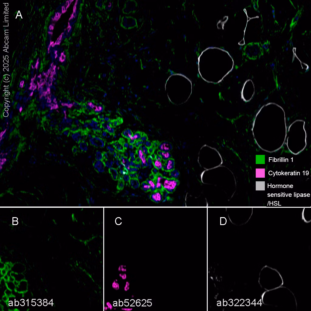 Cytokeratin 19 Antibody Ep1580y Cytoskeleton Marker Ab52625 Multiplex Immunohistochemistry Img449012
