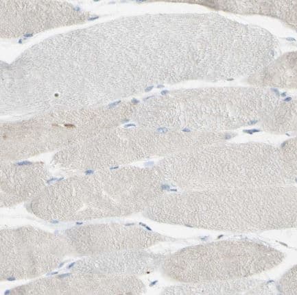 Anti-GDF15 antibody(AB211364)