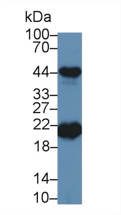 Anti-Ferritin Heavy Chain antibody(AB231253)