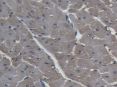 Anti-H-FabP antibody(ab231568)