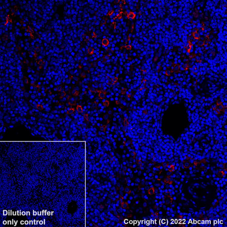 Alexa Fluor® 647 Anti-Sialoadhesin/CD169 antibody [SP216](AB306568)