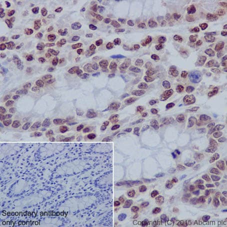 Anti-Histone H3 (tri methyl K27) antibody [EPR18607] - ChIP Grade(AB192985)