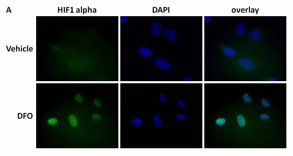 Anti-HIF-1 alpha antibody [EP1215Y](ab51608)