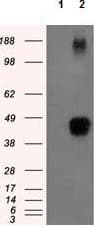 Anti-Tristetraprolin/TTP antibody [OTI8B5](AB124024)