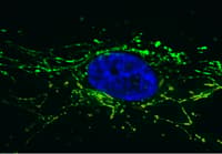 Anti-Pyruvate Dehydrogenase E2 antibody [15D3G9C11](AB110332)