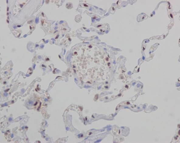 Anti-FLI1 antibody [EPR4646](AB133485)