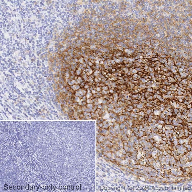 Avidin/Biotin Blocking Kit(ab64212)